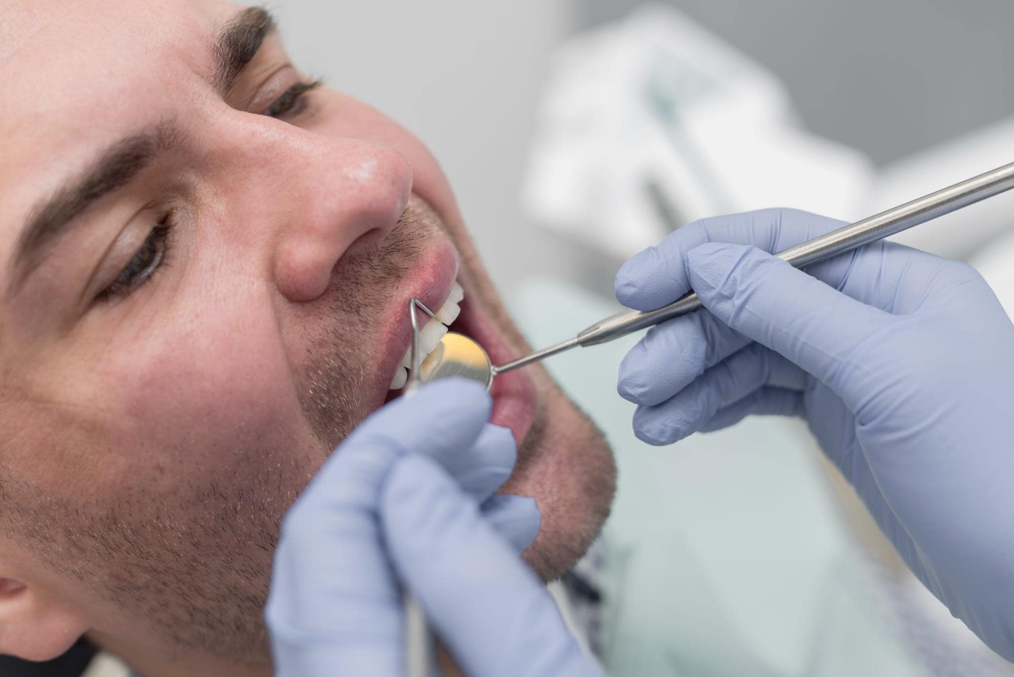 Dental filling treatment at Rose City Dental in Windsor, Ontario
