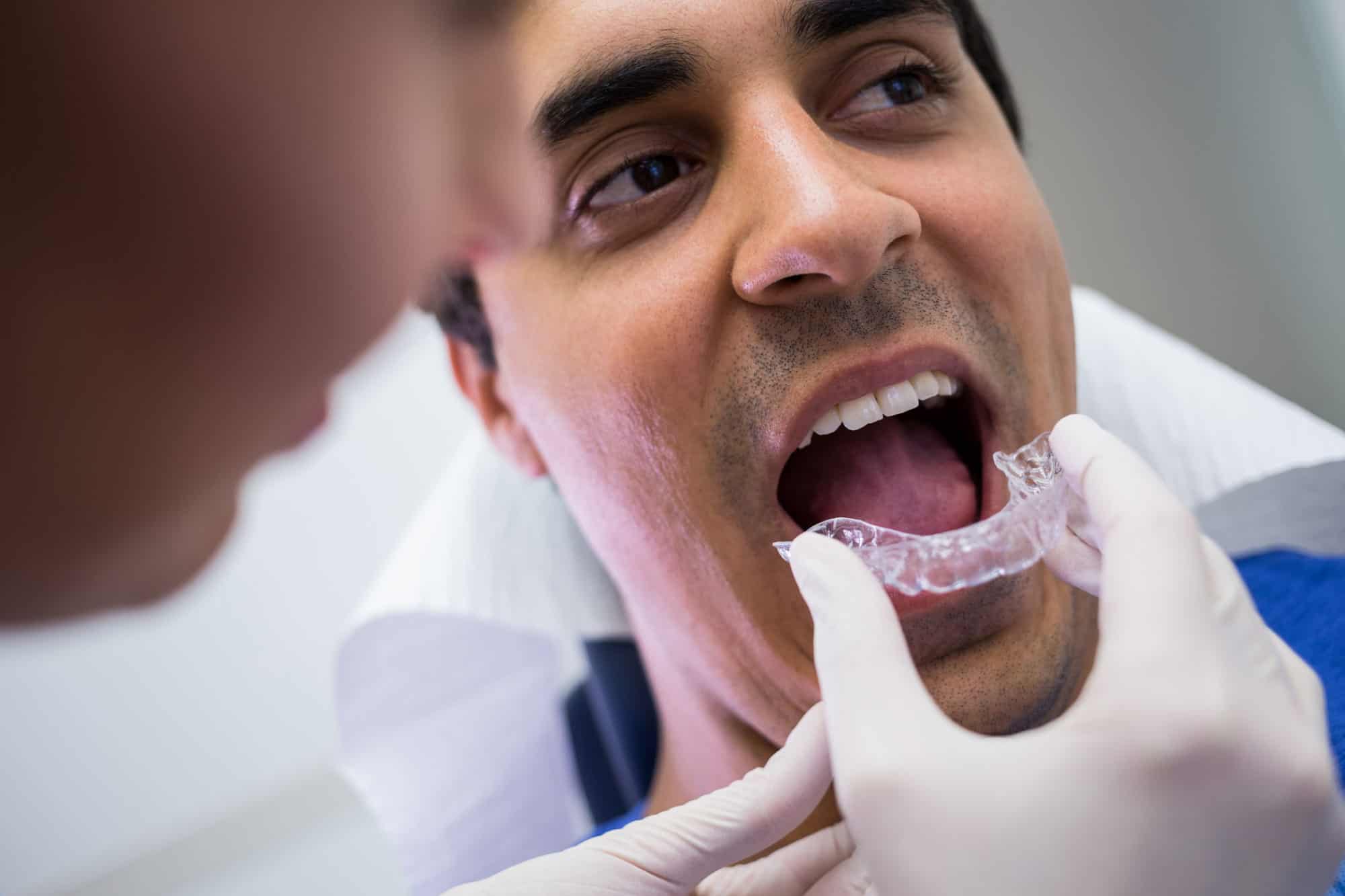 Custom night guard fitting at Rose City Dental in Windsor, Ontario
