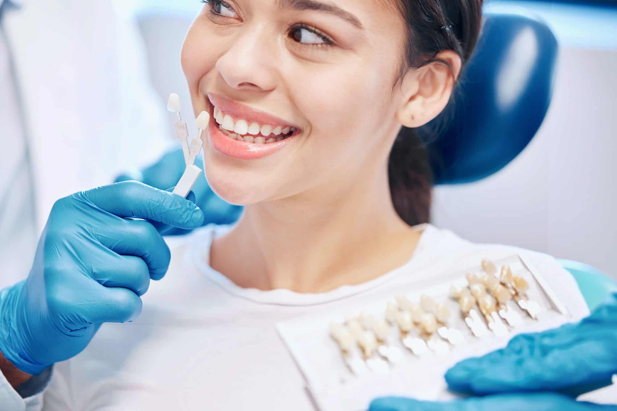 Porcelain veneers shade matching at Rose City Dental in Windsor, Ontario