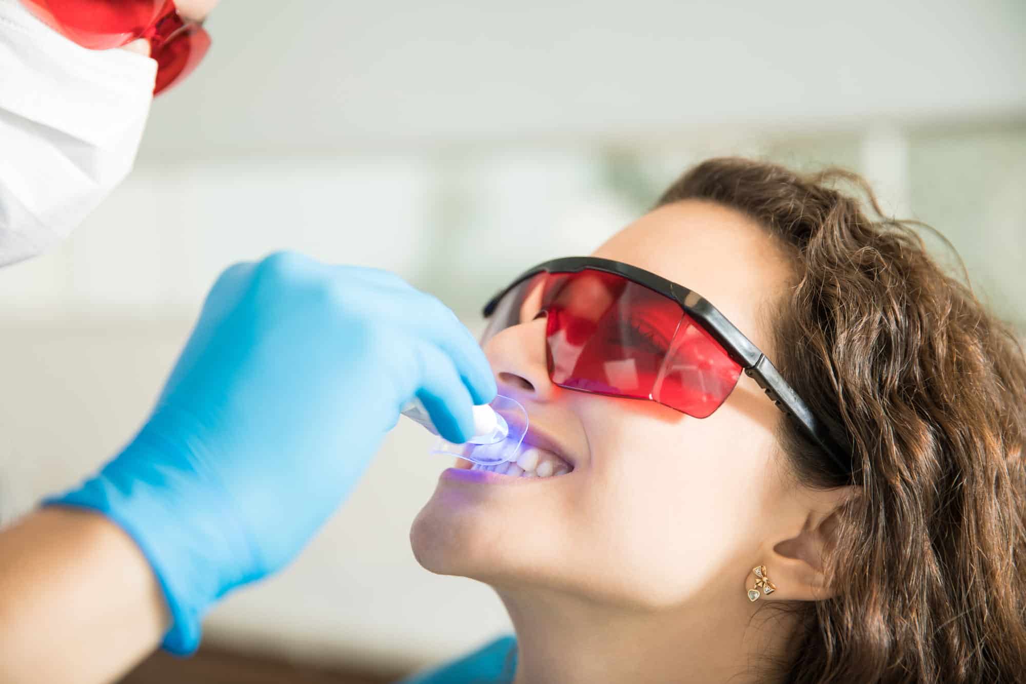 Teeth whitening treatment at Rose City Dental in Windsor, Ontario